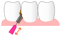 歯間ブラシ